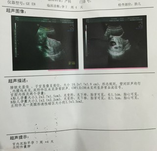 朴素无华 第2页